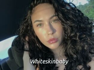 Whiteskinbaby